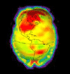 brainwarming